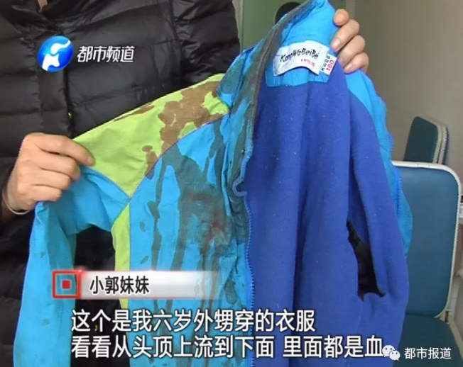  郑州一家三口白天被陌生人锤击 幼女仍在危险期