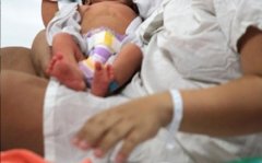孕妇遭枪击身亡 医生30秒紧急剖腹成功救活婴儿