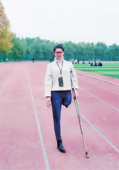 女孩年幼失去左腿未自暴自弃 现如今开公司买房买车