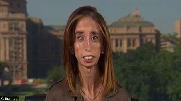 Lizzie VelasquezݣΪŮˡͼƬԴÿʱ