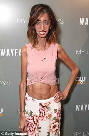 27Lizzie VelasquezݣΪŮˡͼƬԴÿʱ