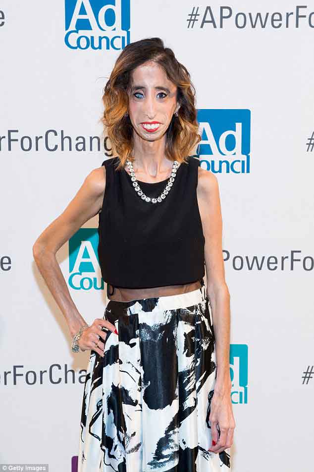 Lizzie VelasquezݣΪŮˡͼƬԴÿʱ