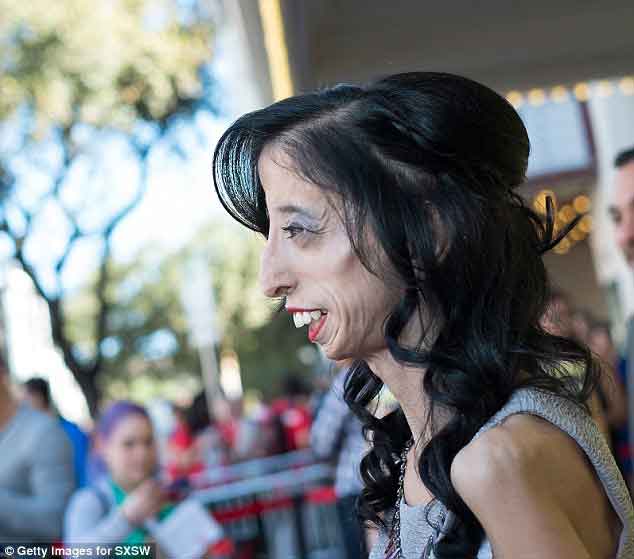 Lizzie VelasquezݣΪŮˡͼƬԴÿʱ